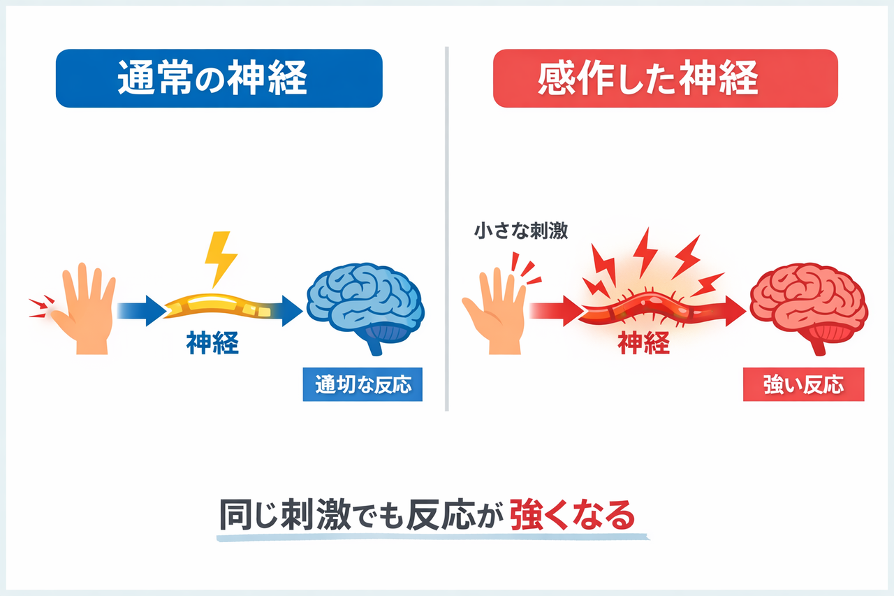 神経感作による変化